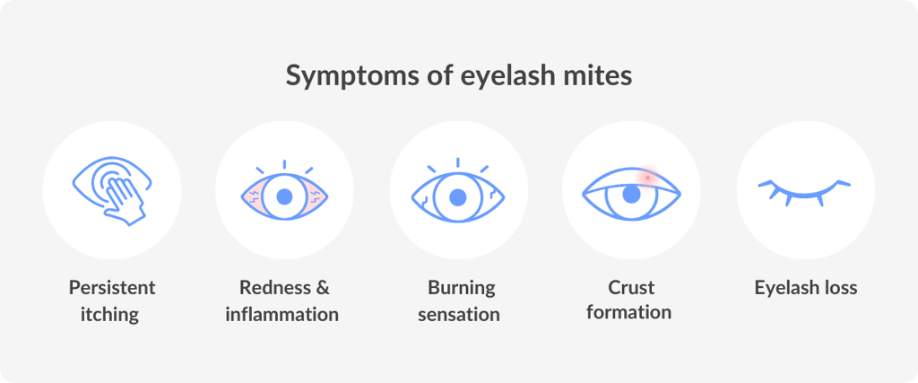 symptoms of eyelash mites