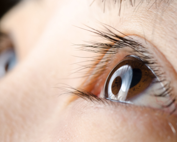 watery eyes