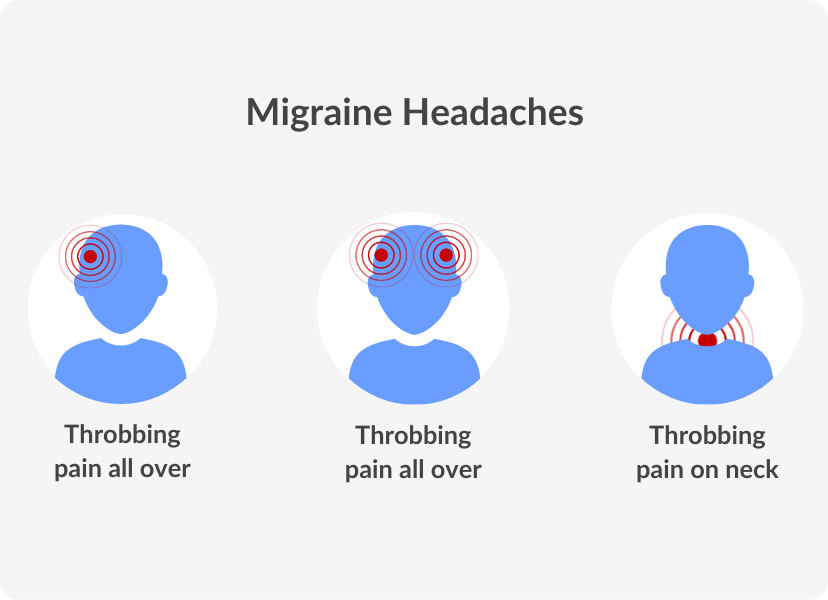 Migraine headaches