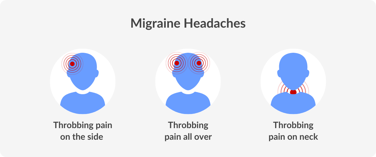 Migraine headaches