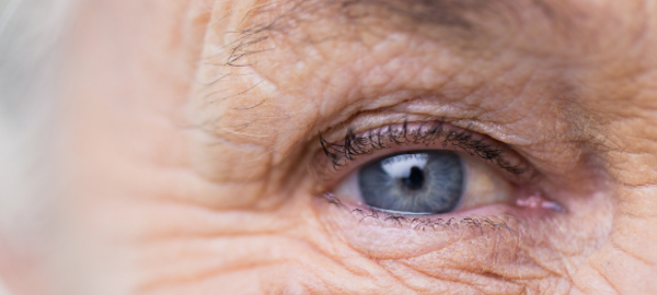 Older person eye- eye floaters