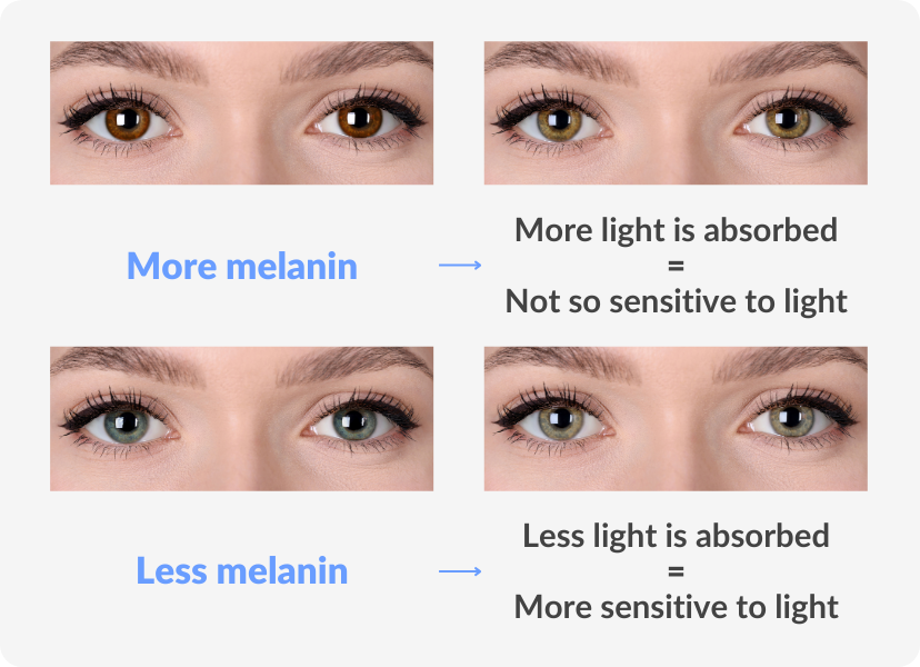 Are Blue Eyes More Sensitive to Light?