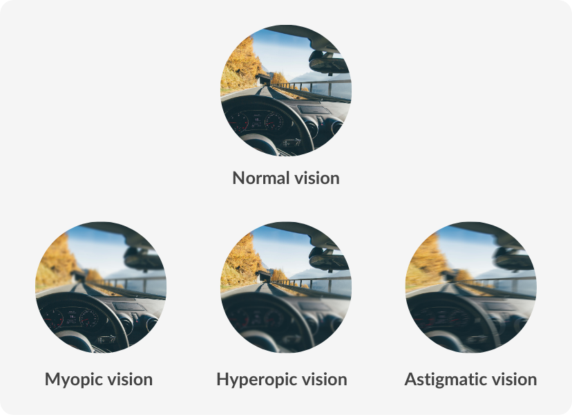 infographic demonstrating myopic vision, hyperopic vision and astigmatic vision compared to unimpaired vision.