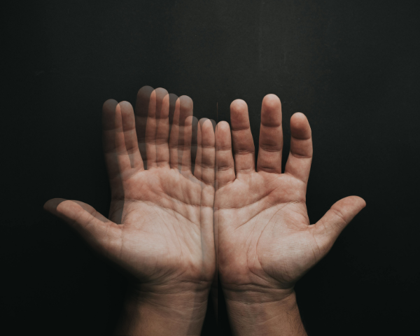 Two hands facing up. Hand on the left is doubled, hand on the right is normal