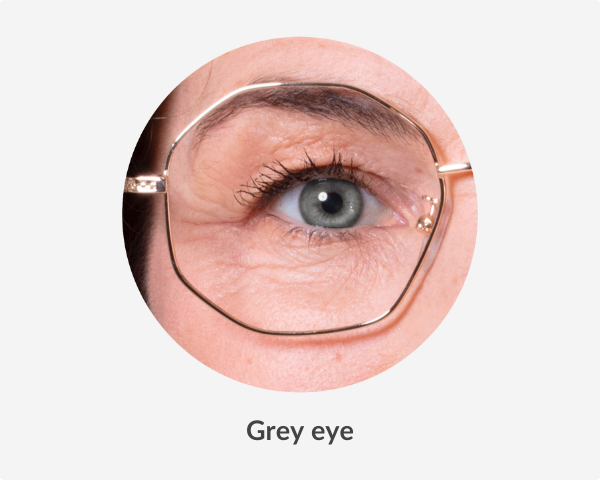 Grey eye