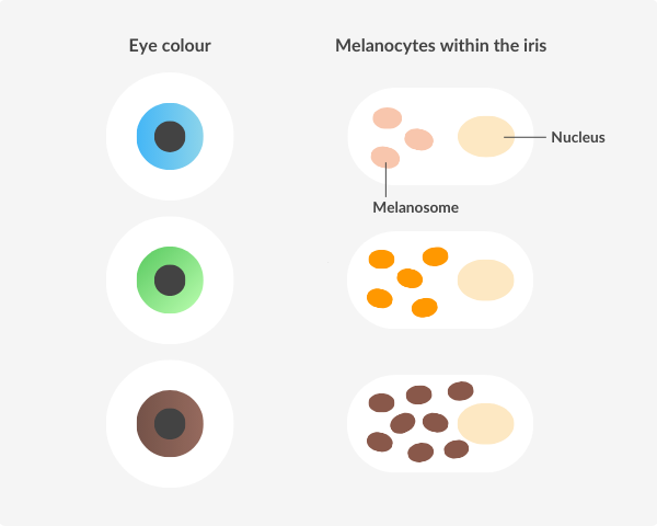 Three eye colors, blue, green, and brown, alongside diagrams of melanocytes within the iris. For blue eyes, the melanocytes contain a few light-colored melanosomes scattered around the nucleus. In green eyes, the melanocytes have deeper orange melanosomes spread evenly around the nucleus. For brown eyes, the melanocytes are densely packed with dark brown melanosomes filling most of the cell