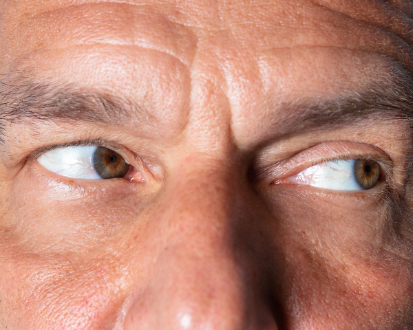 Eye Exercises to Improve Vision