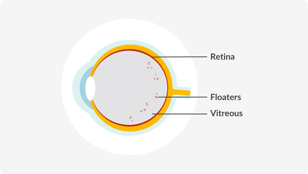 Eye diagram