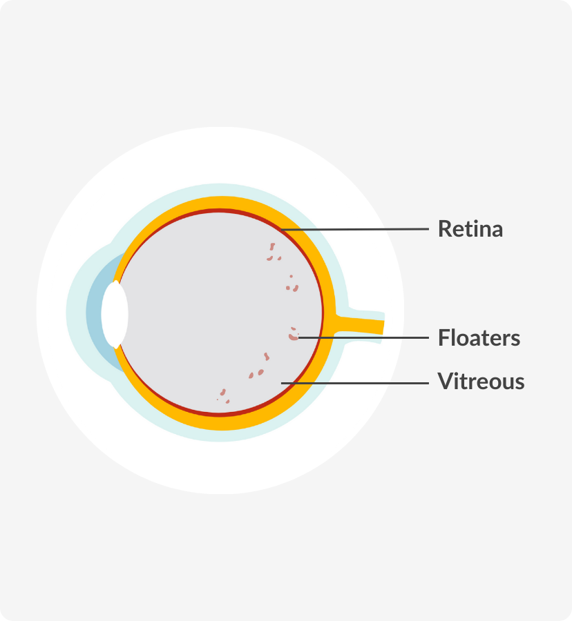 Eye diagram