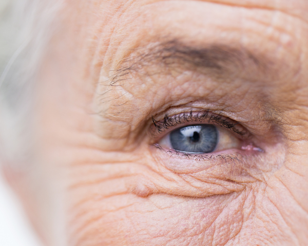 Older Person eye- eye floater guide
