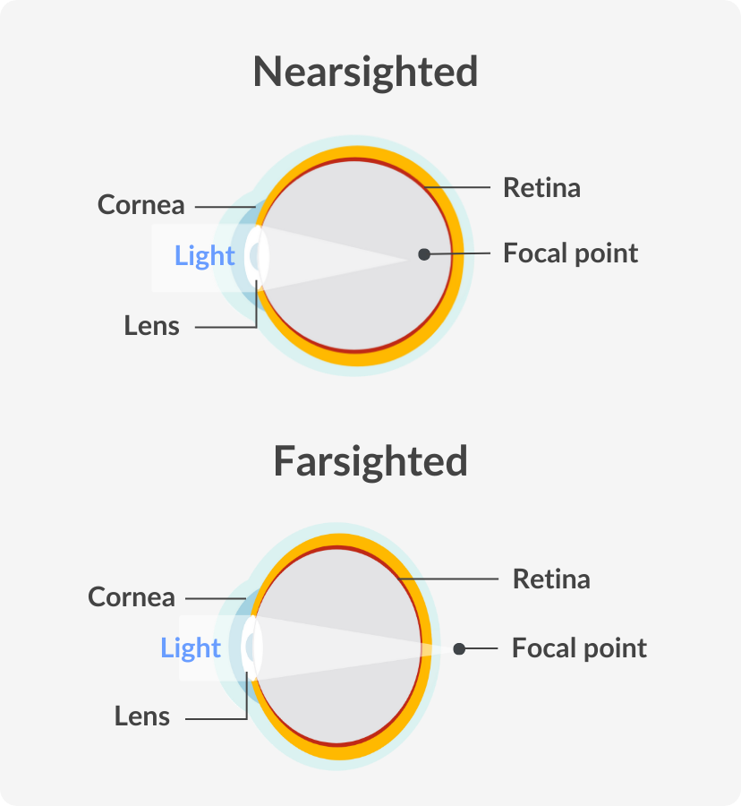 infographic of nearsighted and farsighted