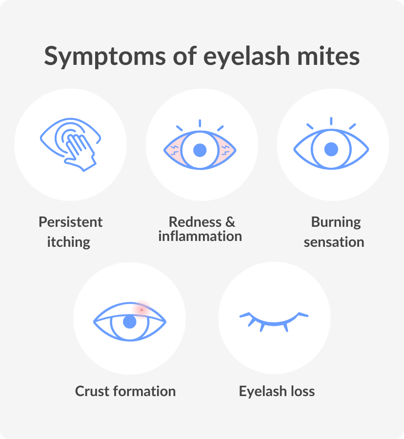 symptoms of eyelash mites