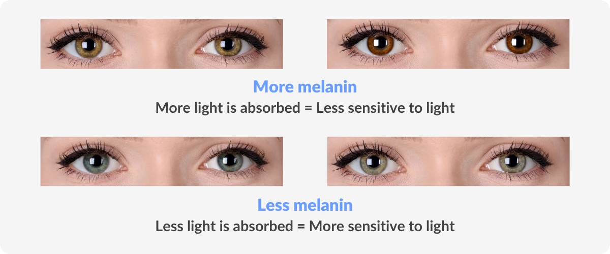 melanin on eyes