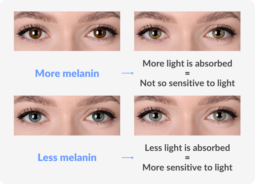 melanin on eyes