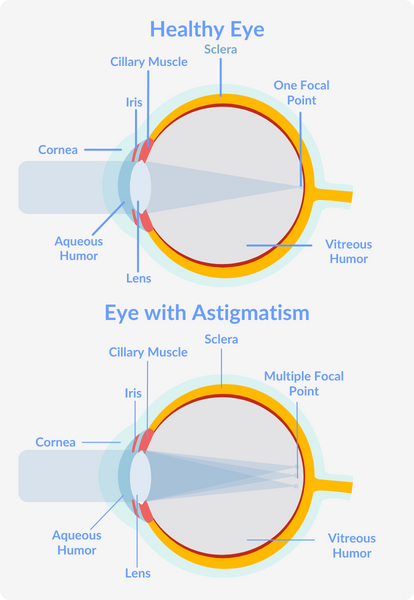 Astigmatism test