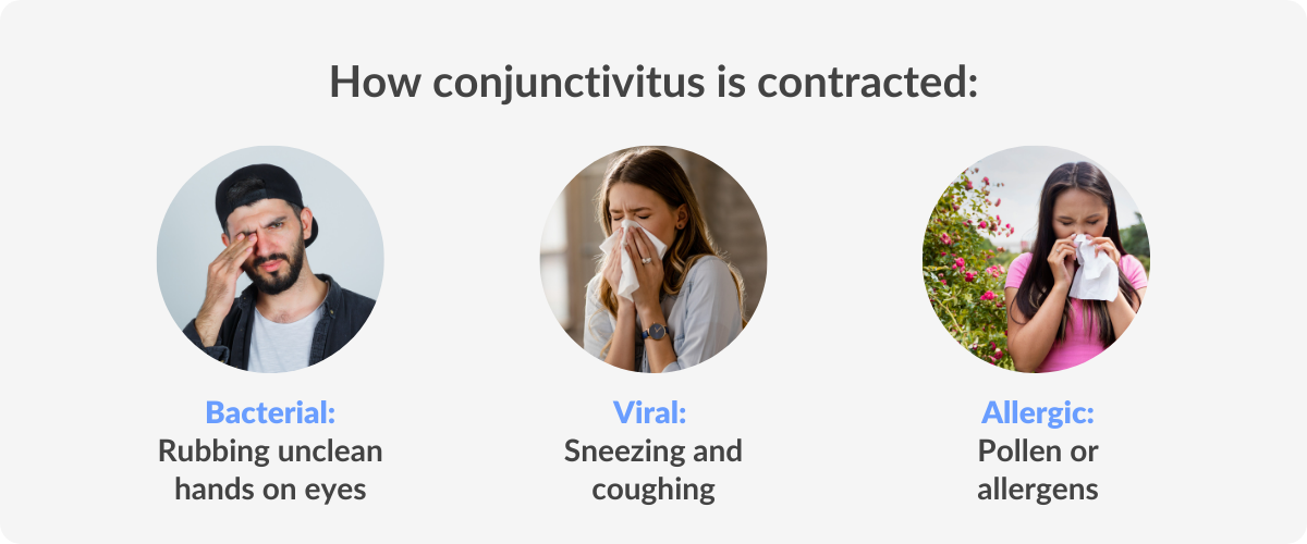 How conjuntivitis is contracted