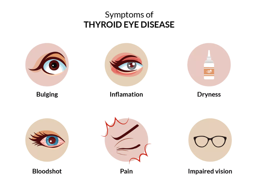 what is thyroid eye disease