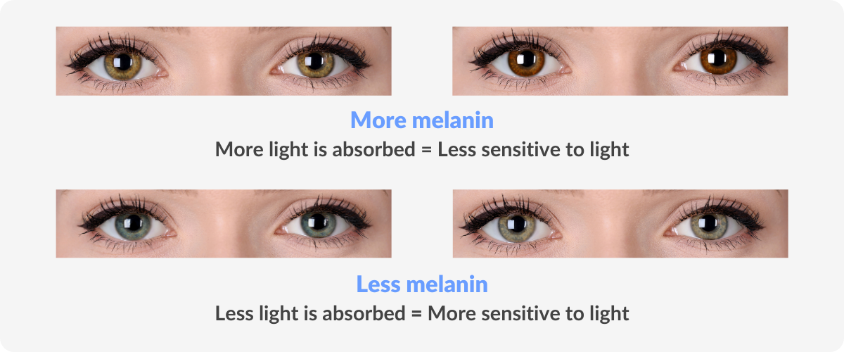 https://image5.cdnsbg.com/cms.smartbuyglasses.com/wp-content/uploads/2023/05/Are-Blue-Eyes-More-Sensitive-To-Light-2-1.png