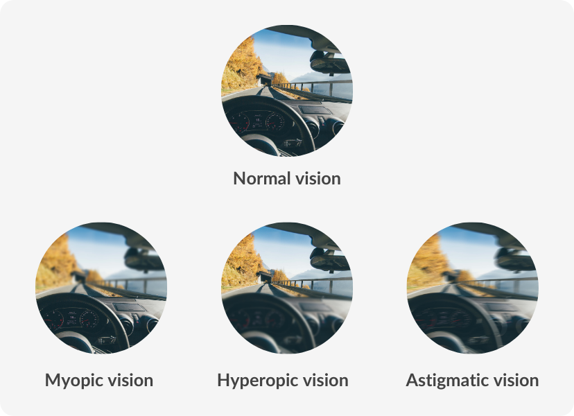 normal, hyperopic, myopic and astigmatic vision comparison