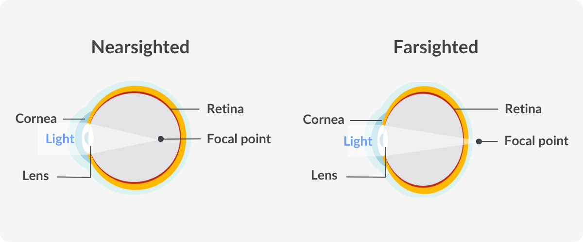 infographic showing the difference between nearsighted and farsighted