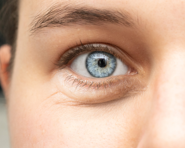 Image of a persons blue eye