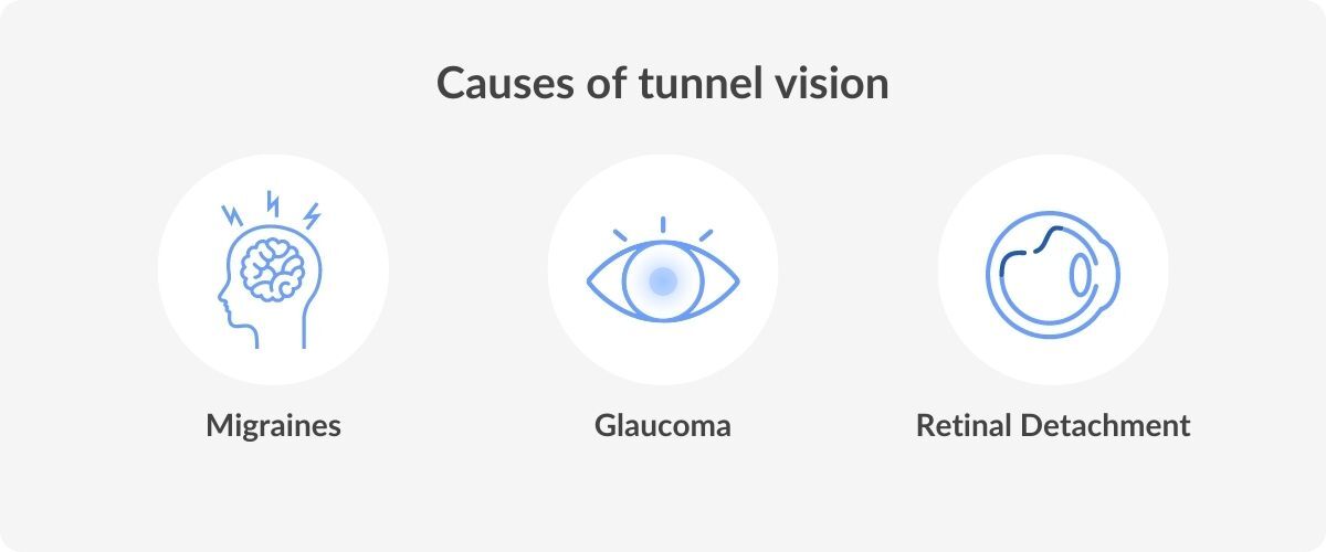 Tunnel Vision (Peripheral Vision Loss): Symptoms, Causes, Treatments