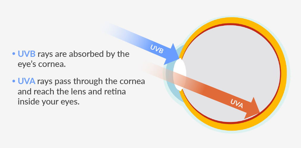 image of the impact of UVA and UVB rays on the eyes