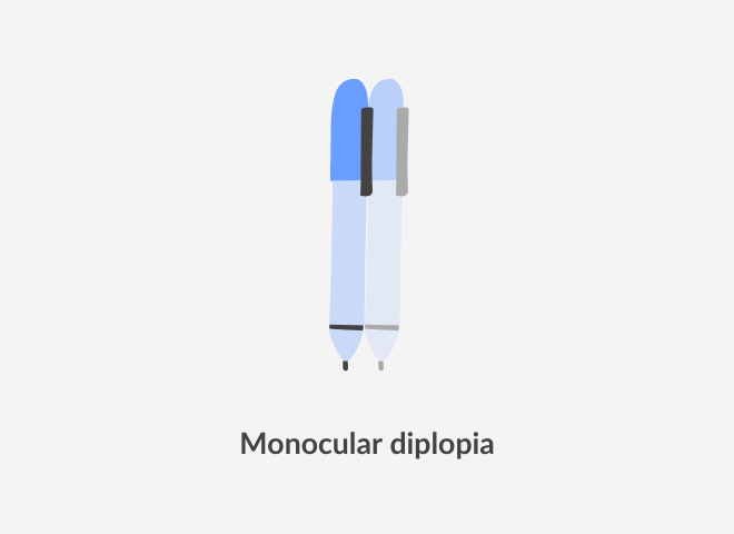 visual representation of monocular diplopia