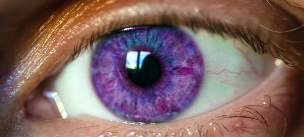 Violet eye
