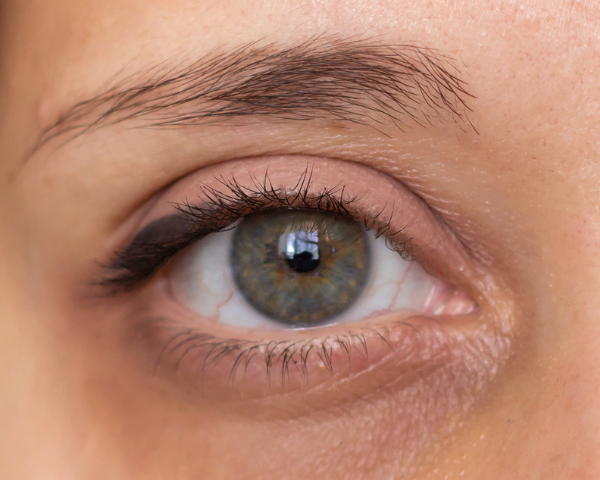 Deep-set eyes