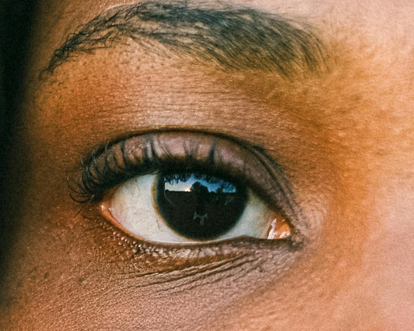Upturned eyes