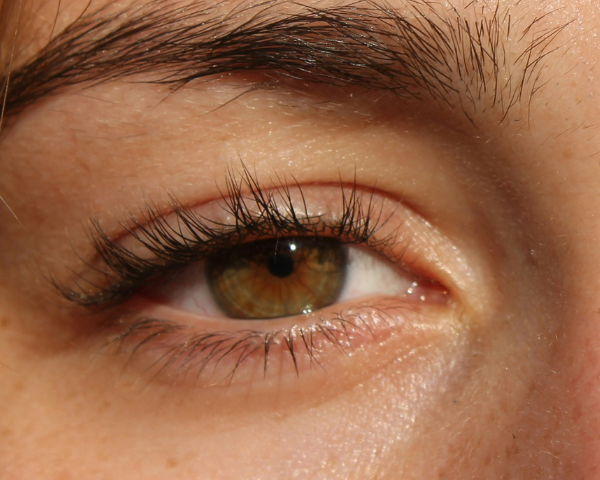 Downturned eyes