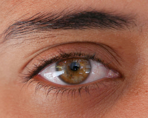 Almond eyes