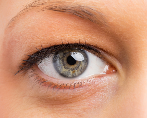 Hooded eyes