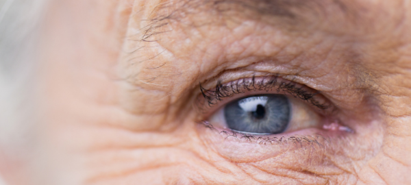 Older persons eye- eye floaters