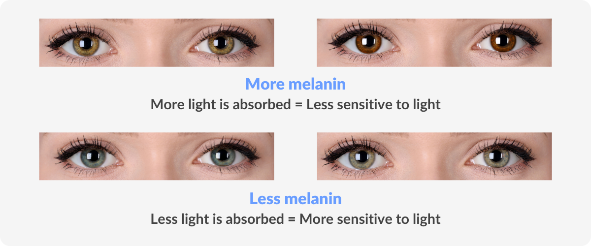 Are Blue Eyes Sensitive To Light? It's Complicated