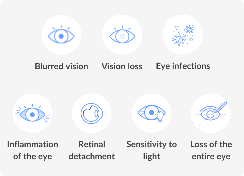 Eye Care Risks The Dangers of Eyeball Tattoos: Risks, Legalities and Safer ...